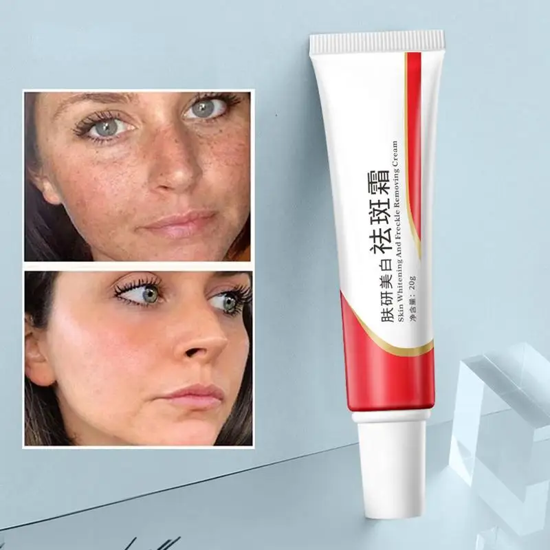 Clareamento da pele, Creme Hidratante e Anti-sarda Creme Repara A Pele e Produtos de Cuidados da Pele Facial